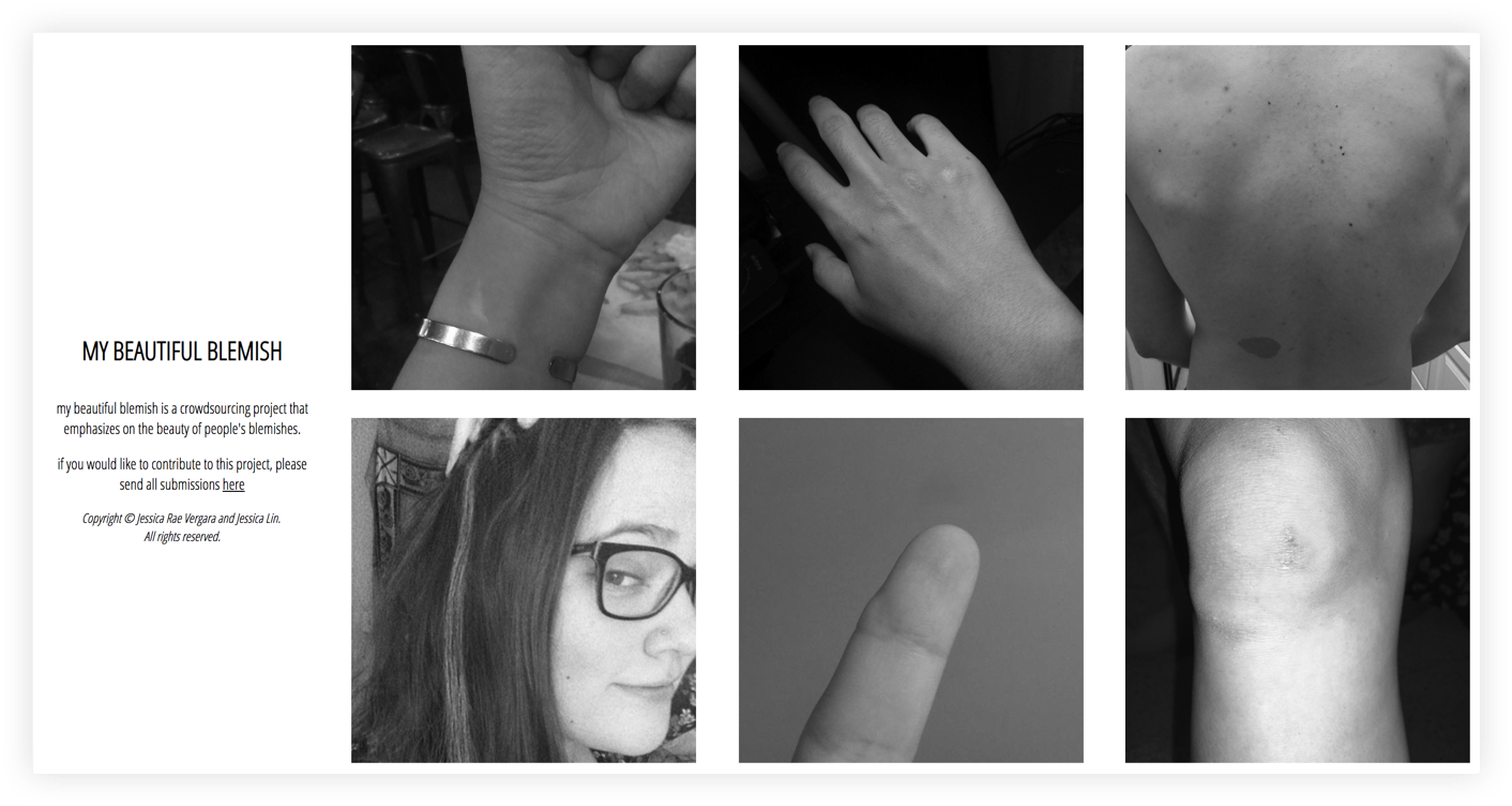 My_Beautiful_Blemish